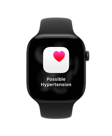 Apple Watch Series 12, fekete alumíniumtok, lehetséges hipertóniával kapcsolatos értesítés, fekete sportszíj