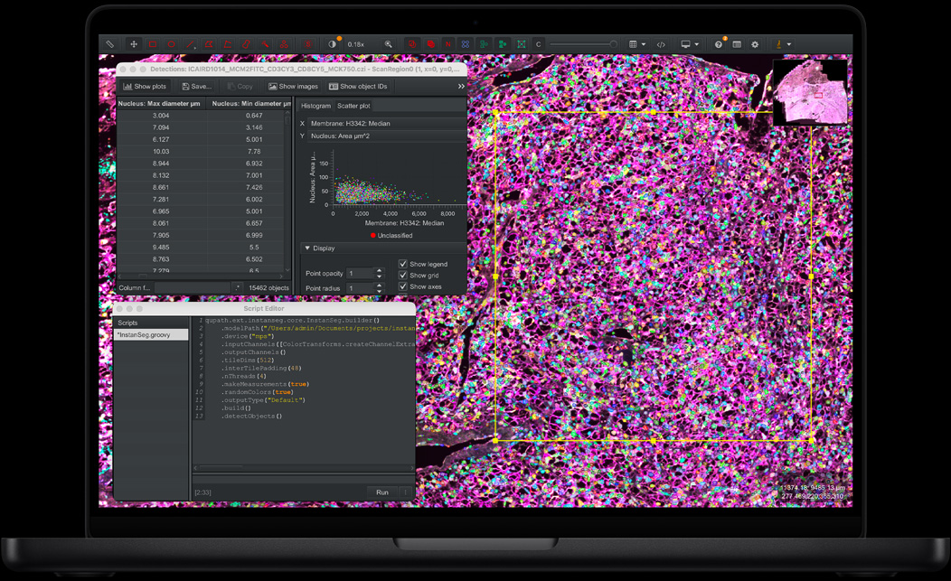 MacBook Pro, QuPath, échantillon de tissu coloré par fluorescence en rose, violet et vert, panneau Éditeur de scripts avec du code, tableau des détections indiquant les mesures du diamètre des noyaux, nuage de points